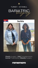 before-after photo roux-en-y-gastric-bypass