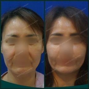 SAERO Plastic Surgery