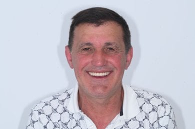 All-on-4 dental implants result at Unident Clinic – restored smile and natural-looking teeth