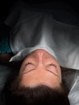 Brow lift result at Op. Dr. Sinan Eroglu Clinic – smoother forehead and elevated brows