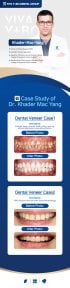 Vorher-nachher-Ergebnisse Emax-Veneers bei Wuhan Yiya Simei Dental Hospital, Lächeln-Transformation