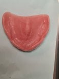 Upper jaw denture base for All-on-4 dental implants at SoftDentalCare Clinic