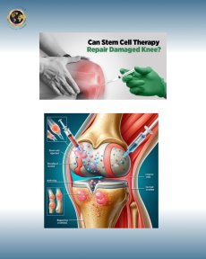 before-after photo stem-cell-rejuvenation-therapy
