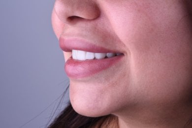 before-after photo implantacia-zuba