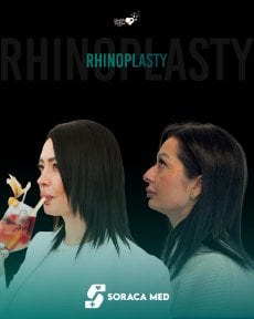 before-after photo rhinoplasty-nose-job