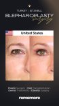 Before and after blepharoplasty results at Memorial Bahçelievler Hospital, eyelid surgery