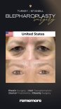 Before and after blepharoplasty results at Memorial Bahçelievler Hospital, eyelid surgery
