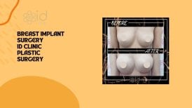 Результаты до и после коррекции грудных имплантов в ID Clinic Bangkok, улучшенная форма груди