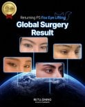 Fox Eye Lift Ergebnisse bei Returning Plastic Surgery – weltweite Augenlifting-Ergebnisse