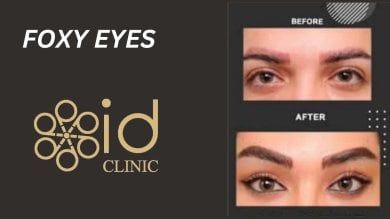 before-after photo lower-eyelid-surgery