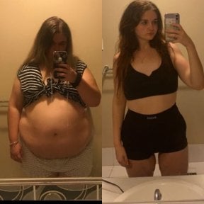 before-after photo ballonirovanie