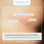 Male breast augmentation scar result at Wansiri Hospital – minimal incision, dissolvable stitches