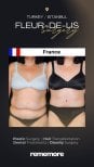 Before and after lower body lift results at Memorial Ankara Hospital, improved abdominal contour