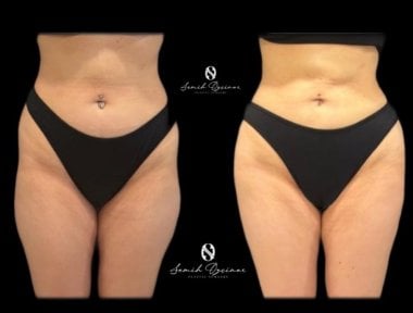 Ортопедическая клиника Turan Turan Health Group