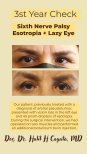 Before and after strabismus surgery for sixth nerve palsy at DrCagatay Eye Clinic, eye alignment result