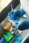 Підготовка до плазмаферезу в INNOVA CLINIC PUNTA CANA, маркування проби крові