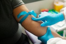 Підготовка до плазмаферезу в INNOVA CLINIC PUNTA CANA для очищення крові