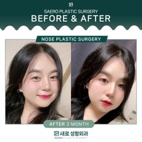 نتائج عملية تجميل الأنف قبل وبعد في SAERO Plastic Surgery بعد 3 أشهر من الجراحة