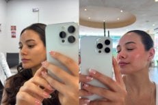 Before and after facial rejuvenation results – smoother, glowing skin after treatment