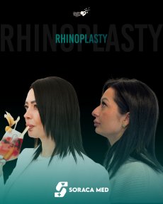 before-after photo rhinoplasty-nose-job