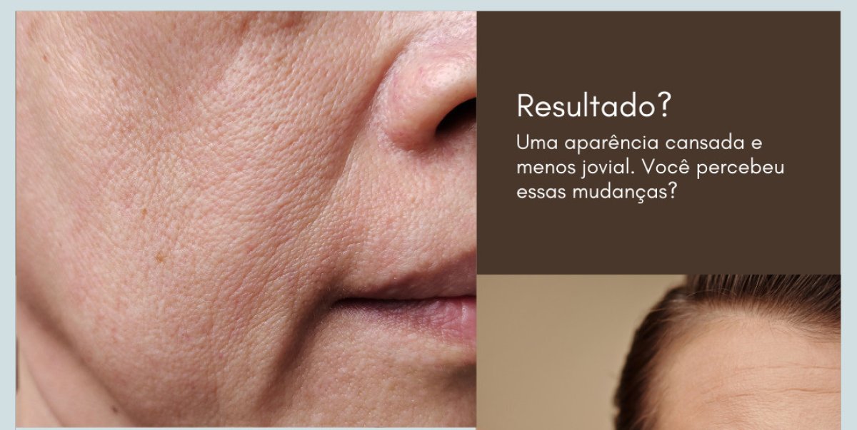 Resultados antes y después de biostimulación: mejor textura facial y menos arrugas