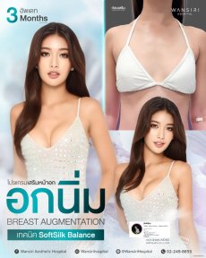 before-after photo breast-augmentation