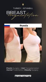 before-after photo brazilian-butt-lift