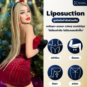 before-after photo double-chin-liposuction