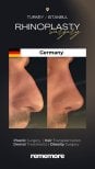 Résultats avant/après rhinoplastie à Memorial Bahçelievler Hospital, chirurgie du nez