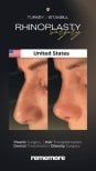 Résultats avant et après rhinoplastie à Memorial Bahçelievler Hospital, remodelage du nez