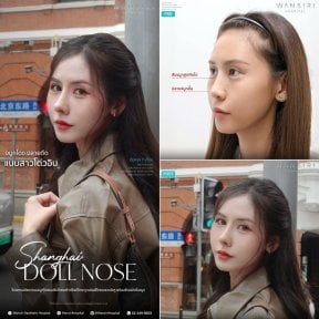 Efekty przed i po plastyce nosa w Wansiri Hospital, metoda Shanghai Doll Nose