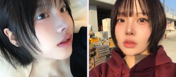 نتائج عملية تجميل الأنف قبل وبعد، إعادة تشكيل الأنف بمظهر طبيعي لمريضة