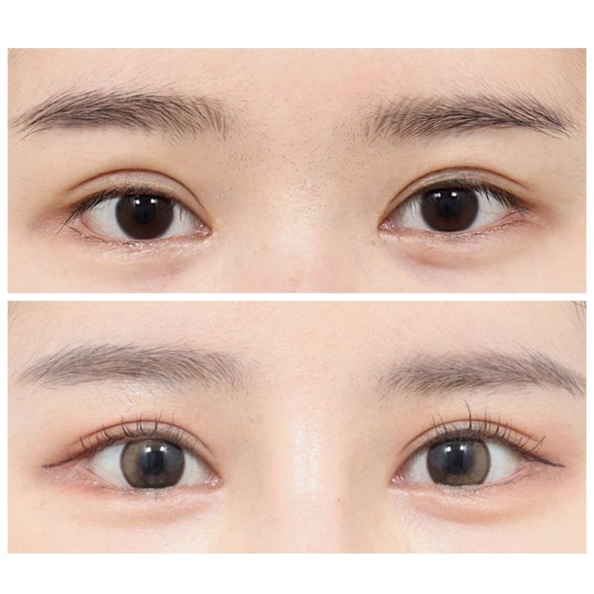 Resultados de blefaroplastia superior en AB Plastic Surgery, mirada más luminosa