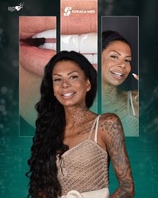 before-after photo zirconia-crown-installation