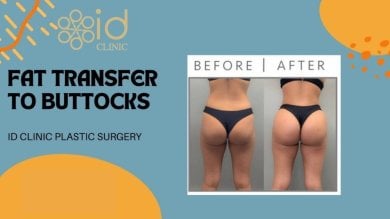 before-after photo mastopexy-breast-lift-contour-plastics