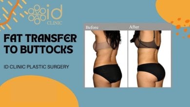 before-after photo brazilian-butt-lift