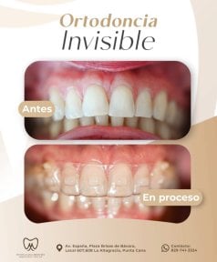 before-after photo elaynery