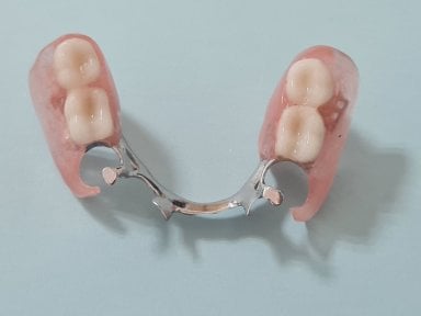 before-after photo denture