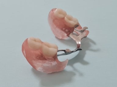 before-after photo denture