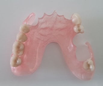 before-after photo denture