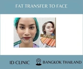 before-after photo tightening-of-facial-skin-facelift