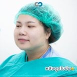 Facial contour improvement after Vaser liposuction at Cosmacare Clinic Center, visible result