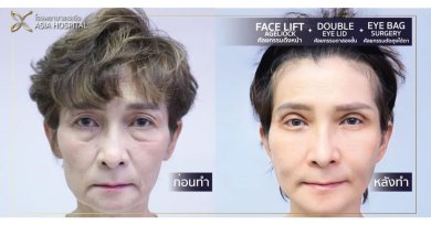 نتائج شد الوجه العميق قبل وبعد في Asia Cosmetic Hospital، تجديد شباب الوجه واضح