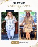 Before and after gastric sleeve surgery at Estexper Clinic – 32 kg weight loss in 7 months