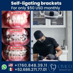 before-after photo braces