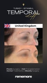 before-after photo upper-eyelid-surgery