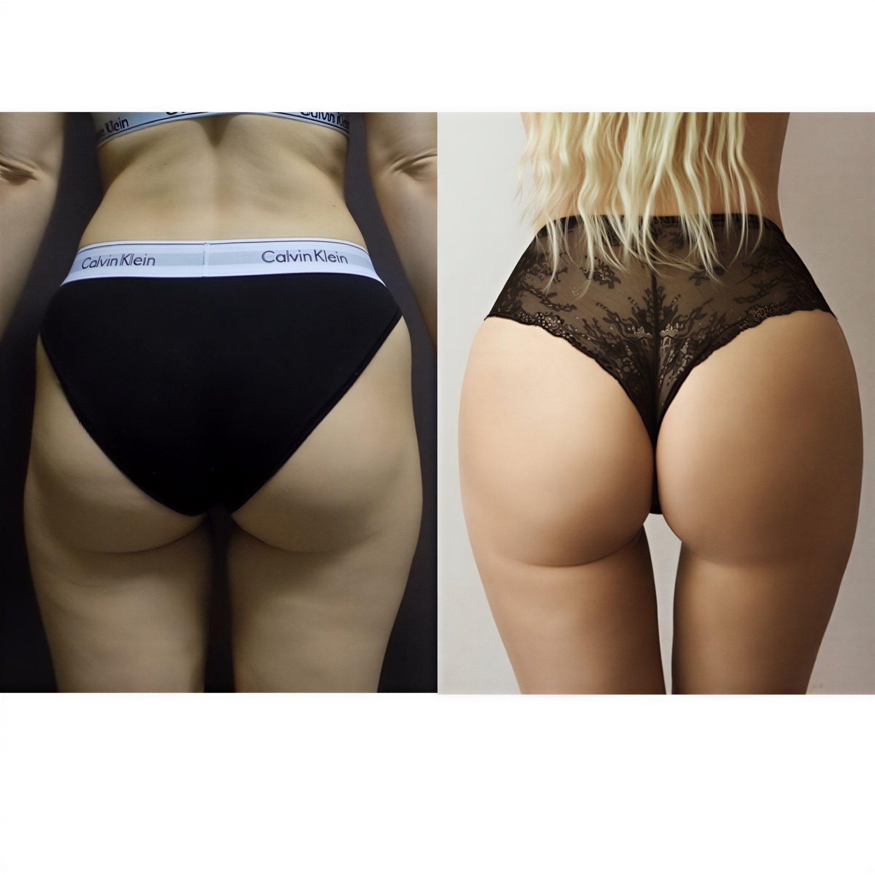 Resultados antes y después de Brazilian Butt Lift en FORME Clinic – glúteos realzados