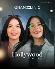 Hollywood Smile before and after results at Grand Clinic – enhanced white, even teeth