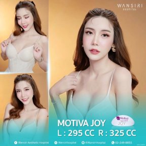 before-after photo monsplasty