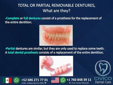 before-after photo denture